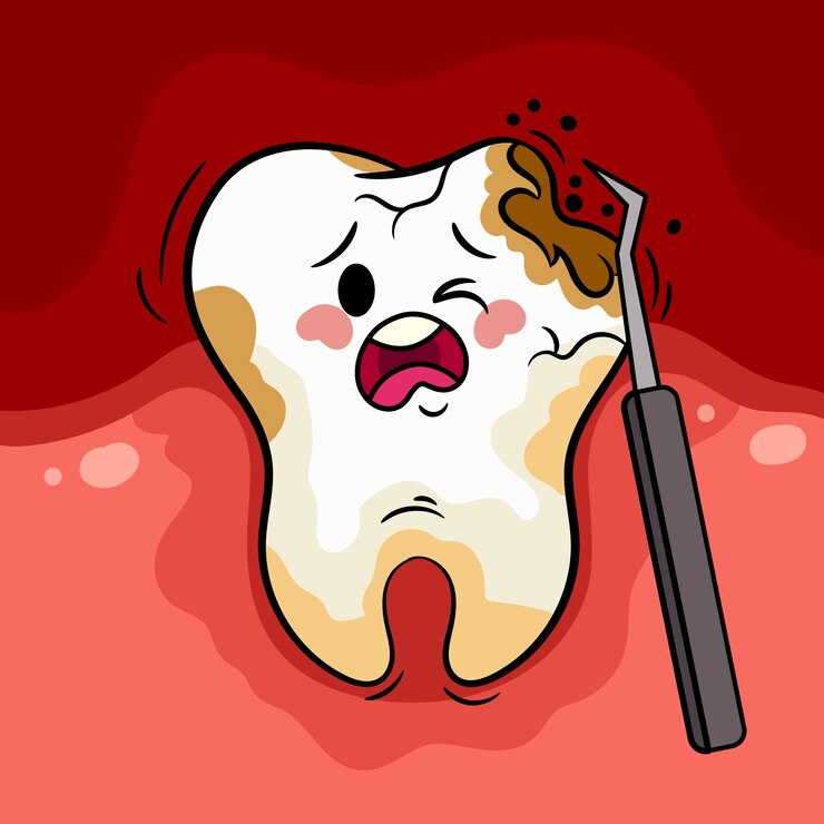 Representation of a tooth decay